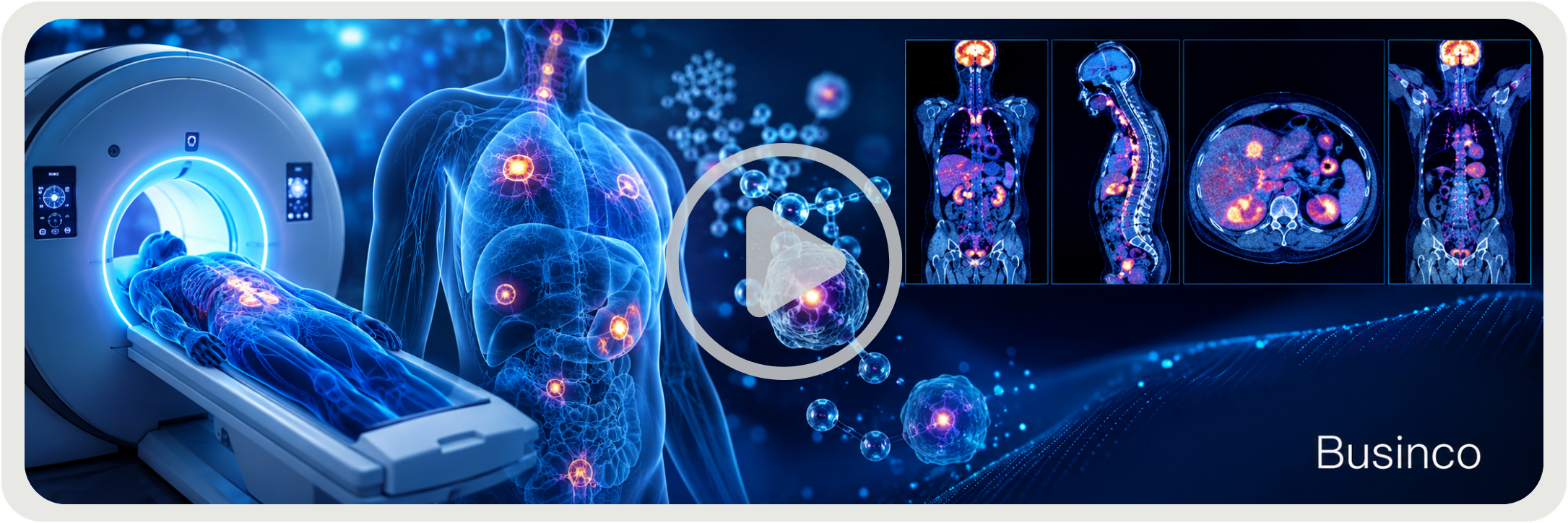 Medicina Nucleare Businco Medicina Nucleare Businco